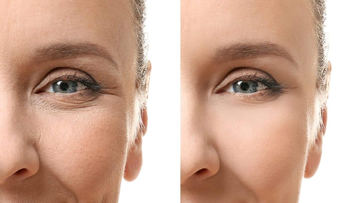 Cildi  kırış kırış yapan besinler! Zehir saçıyorlar